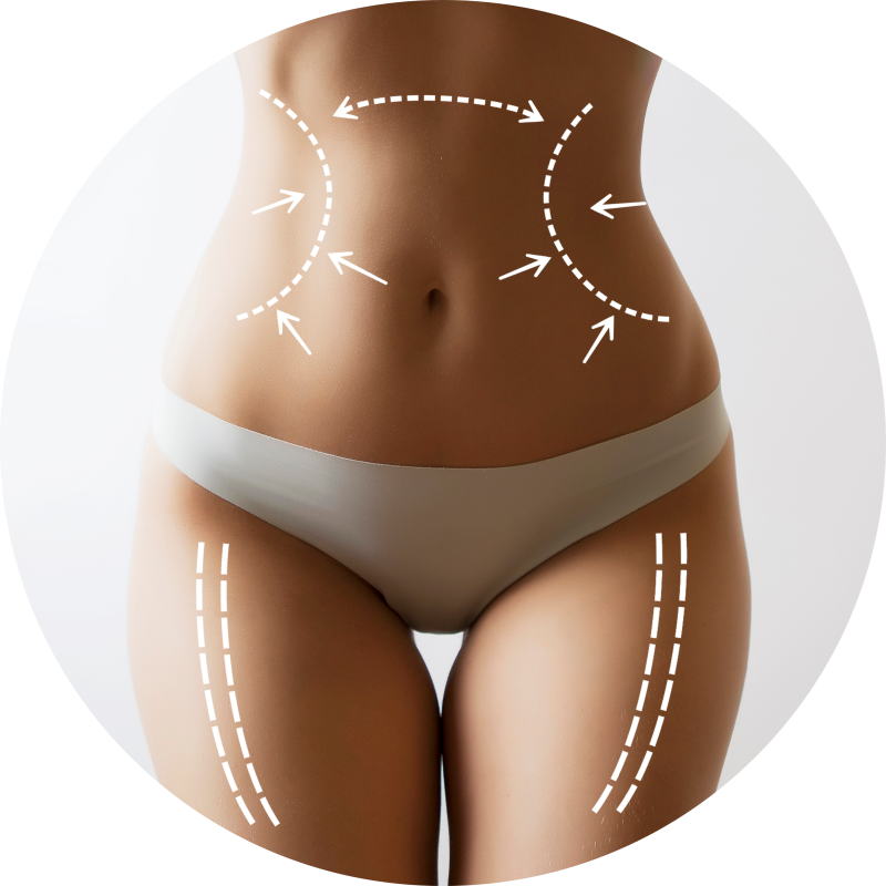 liposukcja-zabiegi-modelujace-sylwetke
